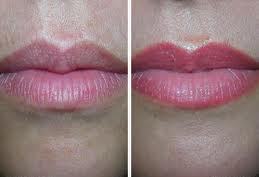 Como poner correctamente el maquillaje de color cuando hay una pigmentación